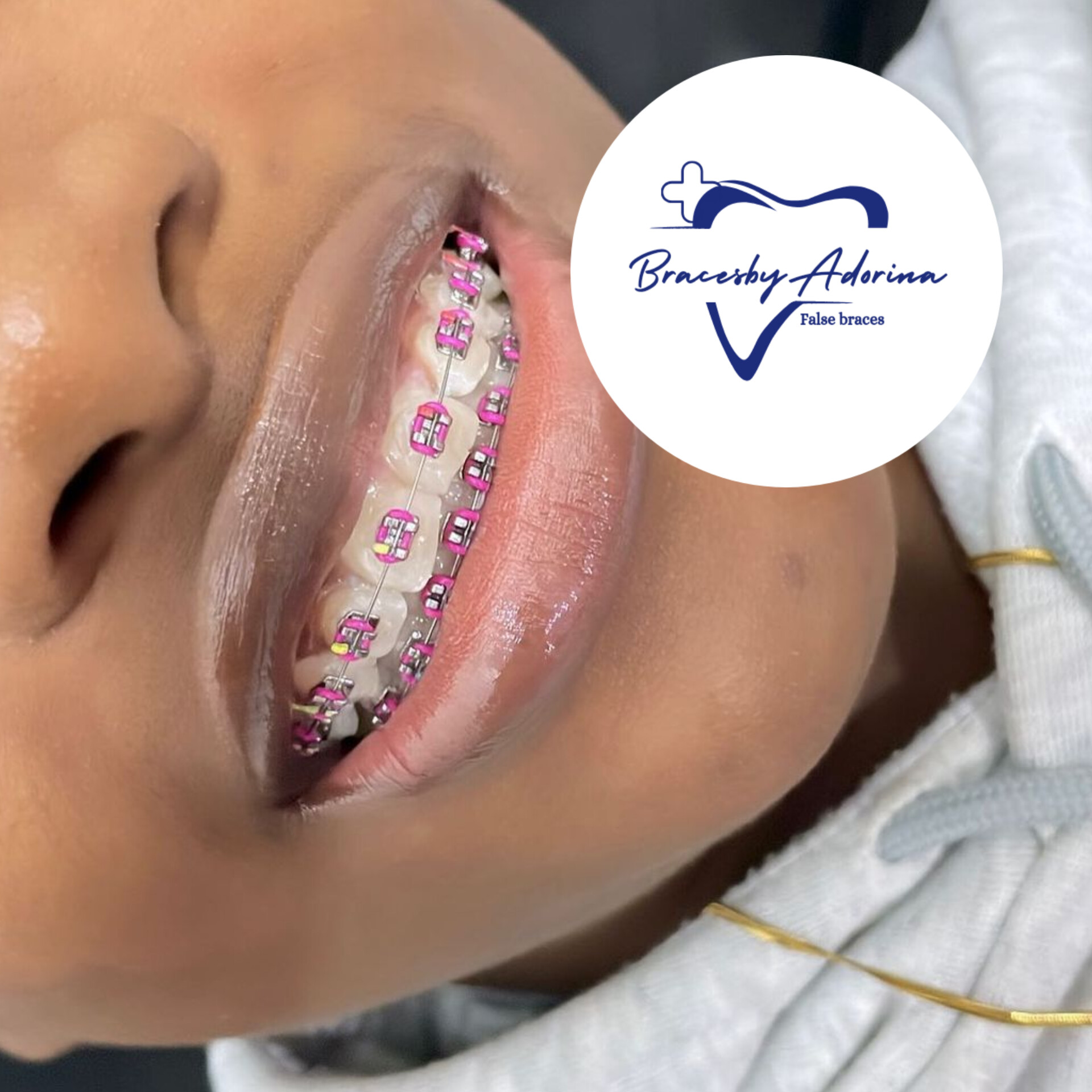 BracesByAdorina Team at work